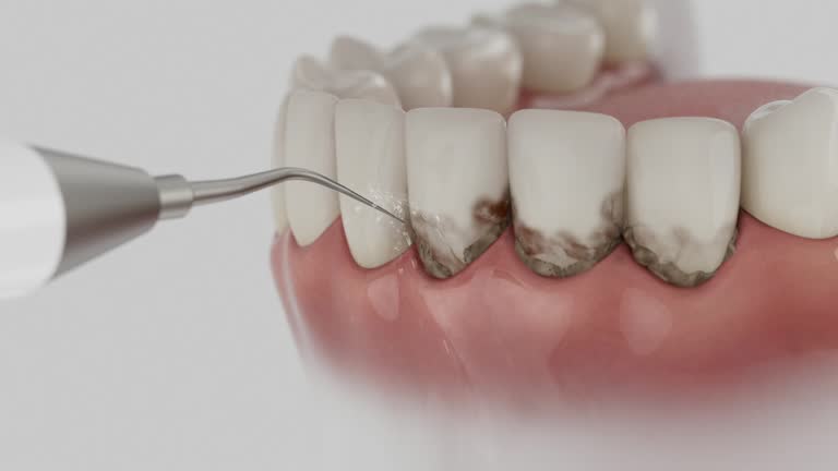 Reliable Teeth Cleaning And Checkup contractor in Buchanan County County, IA by Dentist Open Now